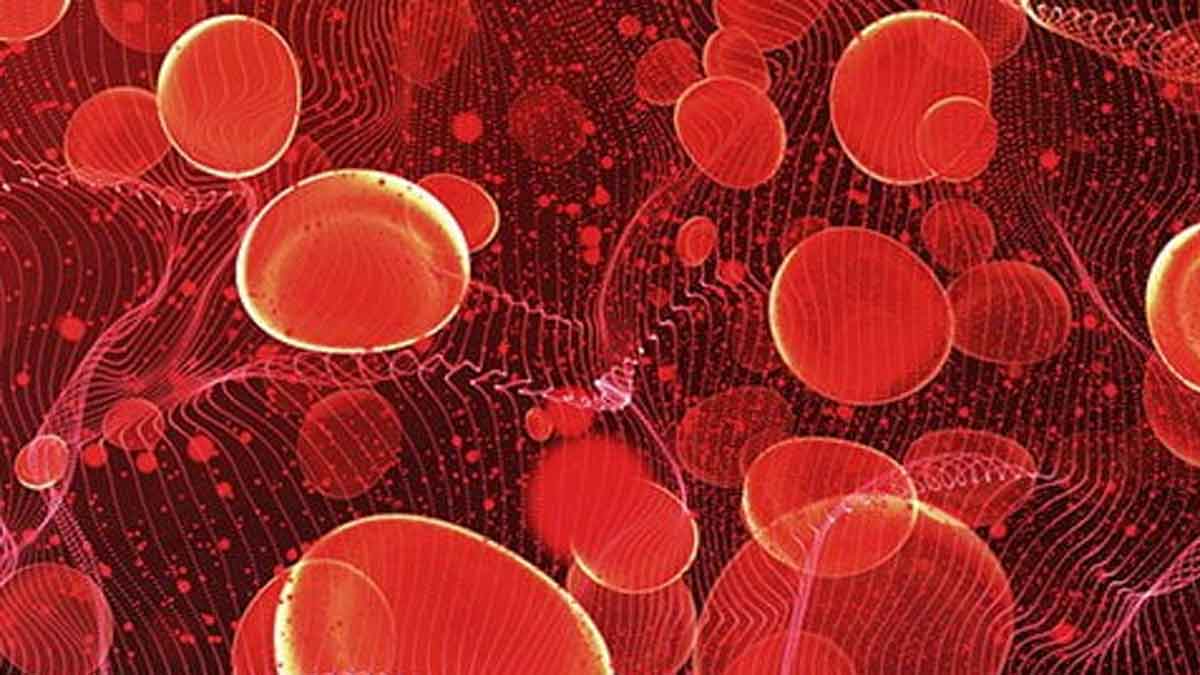 Anemia symptoms know what to do 