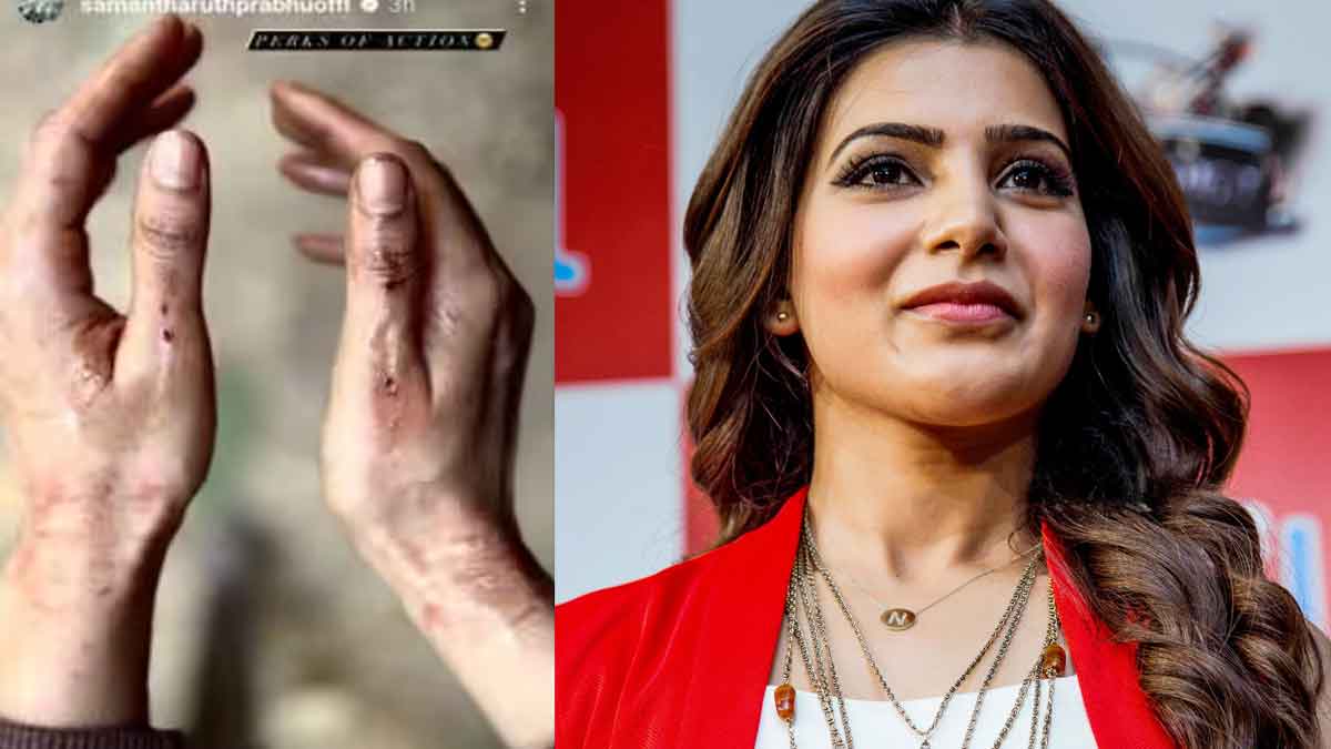 Samantha : సమంత చేతులకి గాయాలు.. రక్తం కారుతున్న చేతులు చూసి షాక్లో ఫ్యాన్స్.. Samantha got injured while movie making photo viral